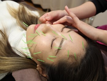フルケアファミリー鍼灸整骨院の写真/国家資格保有者があなたのお悩みに真摯に向き合います！美容鍼クーポンもあり☆初めての方にもおすすめ！