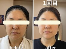 カルナー 武蔵小杉/