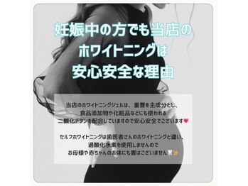 ホワイトニングショップ 葵区静岡駅店/ホワイトニング店ホワイトニング