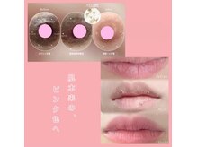 地域初！最新の黒ずみケアローマピンク導入店舗