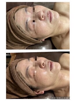 リボーン(be reborn)/肌育で輝く毎日♪