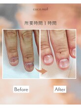 ココ ネイル サロン アンドスクール(COCO.NAIL SALON＆SCHOOL)/爪噛み本気で卒業したい方