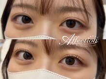 アフェクション アイビューティー(Affection eye beauty)/まつげパーマ