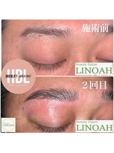 ビューティーサロン リノア(LINOAH)/ハリウッドブロウリフト　2回目