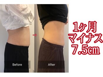 キレピア 新市街店(kirepia)/-7.5ｃｍ！