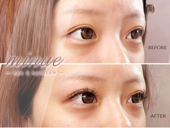 レイズ バイ ミヌ スズカ(raise by minue SUZUKA)/バインドロック上両目