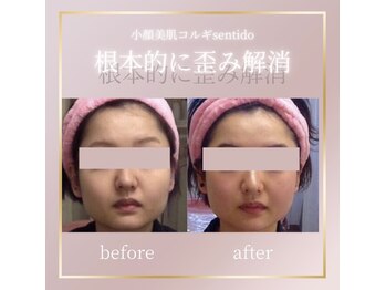 小顔美肌コルギ専門店 センティード 吉祥寺(Sentido)/