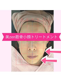 ドリーマー(Dreamer)/シャープなフェイスラインで小顔