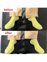 ナオル整体 福岡香椎院(NAORU整体)/40代女性施術事例【右足の開き】