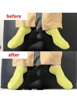 ナオル整体 福岡香椎院(NAORU整体)/40代女性施術事例【右足の開き】