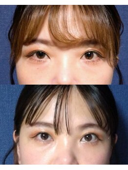 ぐっすりん/複数回継続のお客様の変化(1)