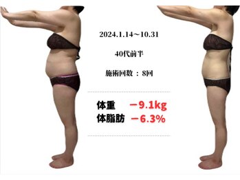 ラヴィ アール(Lavie.R)/痩身/リンパ/リンパマッサージ