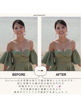 ホワイトニングショップ 西尾店/ホワイトニングで写真映え!西尾