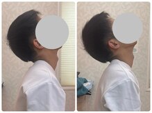 しもえのお整骨院の雰囲気(首の痛みも、一度でこれだけ動くようになります。)