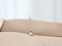 サンズイ(SANZUI)