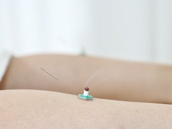 サンズイ(SANZUI)の写真/痛みの少ない全身鍼灸で温かなめぐりの良い体を作り、体調を崩しにくく仕事でも活躍できる