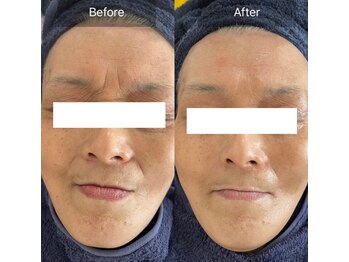 サロン ド カシェット 銀座/お客様のビフォーアフター例