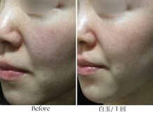 ビボーラ(BEBEAURA)/白玉ホイップトリートメント☆