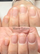 マリーロール 梅田店(Marie Laure)/深爪矯正/自爪育成/自爪風