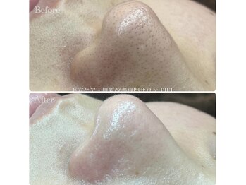 ピエル 北千住店(PIEL)/初めてのお客様