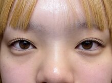 エイジレス(AGELESS)/ポイント→根元に奥行きを出す