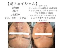 サロンツキ(salon tuki)/光フェイシャル症例