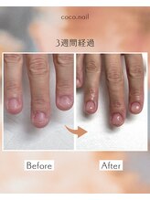 ココ ネイル サロン アンドスクール(COCO.NAIL SALON＆SCHOOL)/クリアジェル　爪噛み　