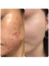 シャイネル(SHYNELL)/