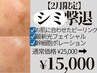 【2月限定シミケア】ピーリング+光フェイシャル+幹細胞ポレーション¥25000→