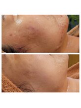 サロンドアクオン(salon de aqon)/どんなお悩みもご相談ください