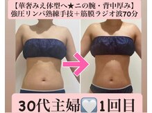 マール(Mar)/ビフォーアフター　痩身/くびれ