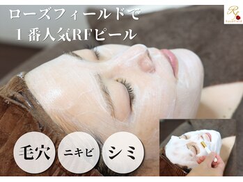 ローズフィールド(Rosefield)の写真/毛穴の汚れをスッキリ洗浄！エステ歴25年の熟練技×RFピールで、触れたくなるなめらか素肌へ導きます