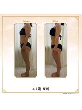 ベルシア 吉祥寺店(BELCIA)/