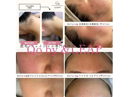 キュオバイアンドリープ(Qo by &LEAP)の写真