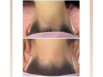 ソワイユ 浜松店(Soyeux)/ワックス脱毛