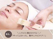 シーズ ラボ 町田店/すぐ始めて！集中ニキビケア