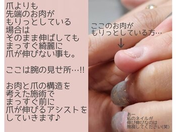 プリンセスネイル(Princess nail)/深爪矯正