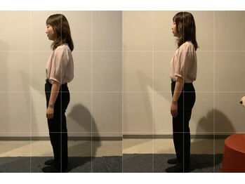 小顔矯正整体サロン イクサス(IxAS)/初回での<before&after>