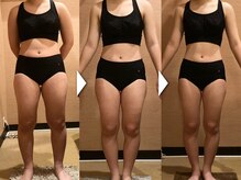 マイン イオンモール浜松市野店/マインの集中痩身！