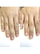 アーティネイルズ(Aaty Nails)/当日から見た目改善