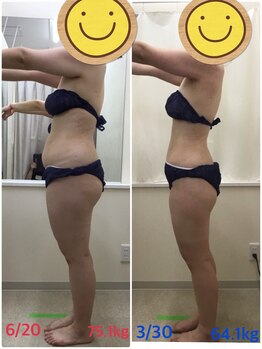 エスティフル 狭山店(ESTIFUL)/[痩身エステ]Before/After