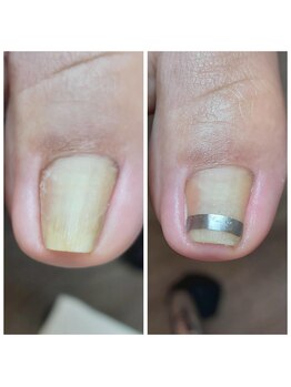 爪切り屋 足楽/