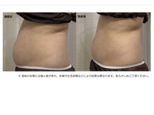 アガット(agete)/トリプルアタック