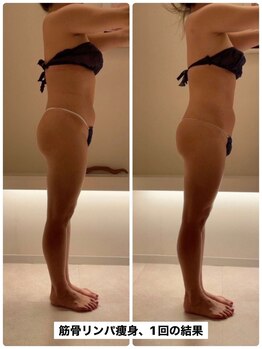 サロン ド カシェット 銀座/お客様のビフォーアフター例