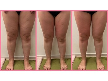 リセットモア(Reset More)/ハイパーシェイプ