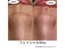 ポレ(pole)/いちご鼻撃退！！