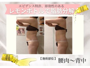 フェアリー 小松店/レモンボトル導入店♪