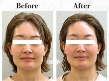 メイヴィ 四日市(Maivi)/30代女性の変化