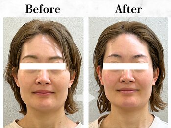 メイヴィ 四日市(Maivi)/30代女性の変化