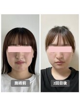 シー 下北沢(sea)/たった2回の施術見違える変化◇